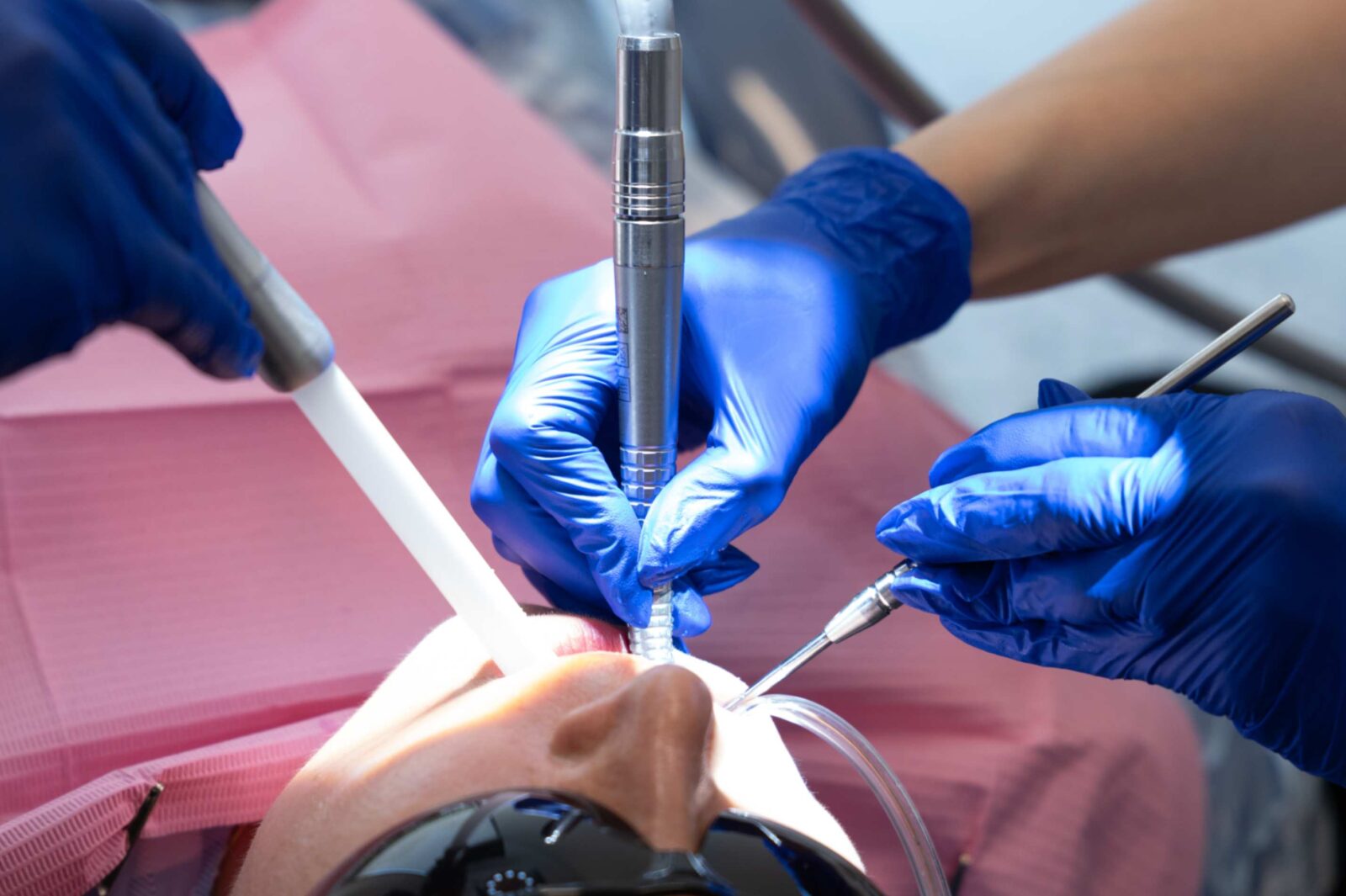 Dental treatment at Mackenzie Smiles Dentistry