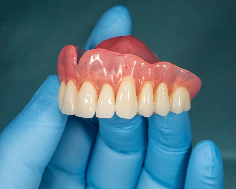 Partial Denture Consultation in Richmond Hill: A Patient Preparation Guide